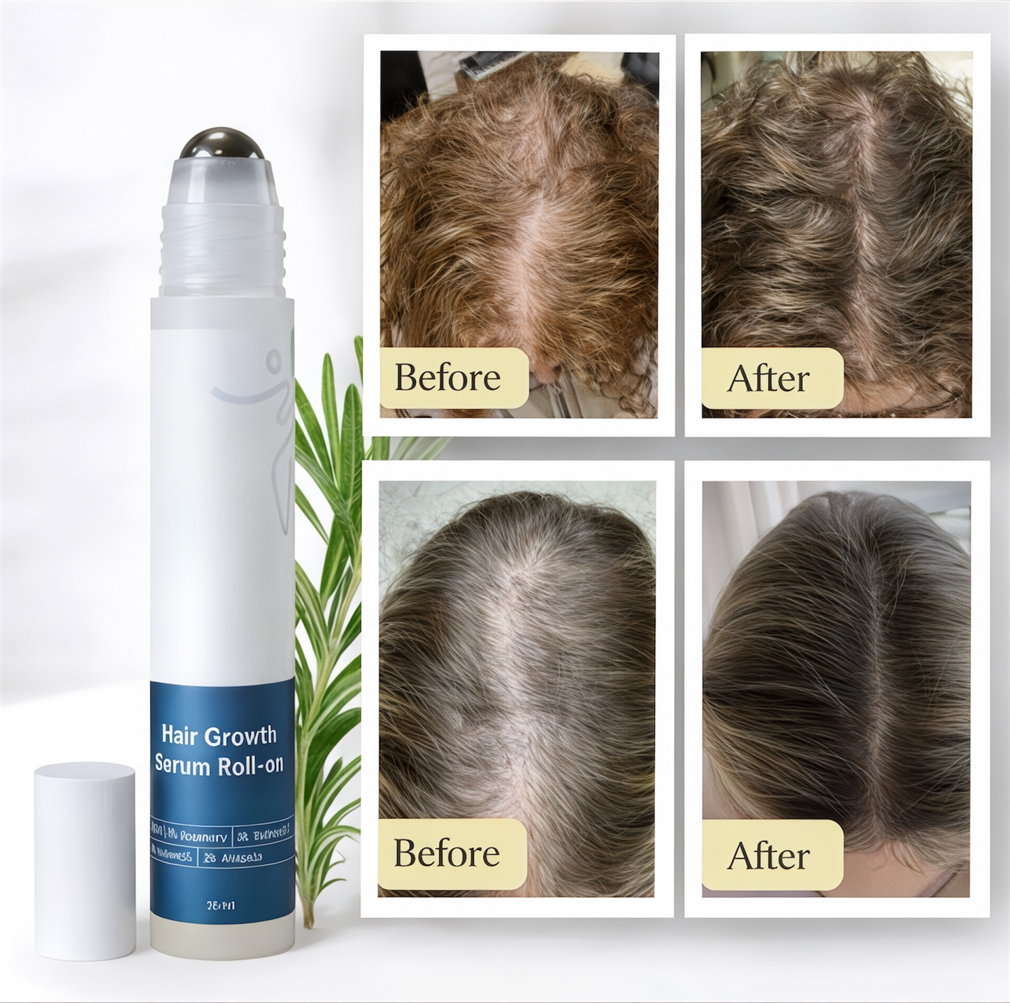 Hair Regrowth Serum for Thicker, Healthier Hair Growth