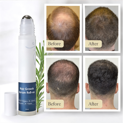 Hair Regrowth Serum for Thicker, Healthier Hair Growth